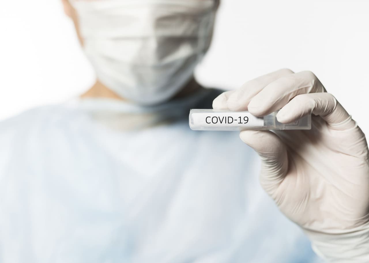 Manoma, kad testų, skirtų nustatyti Covid-19 ligą, kaina yra labai didelė