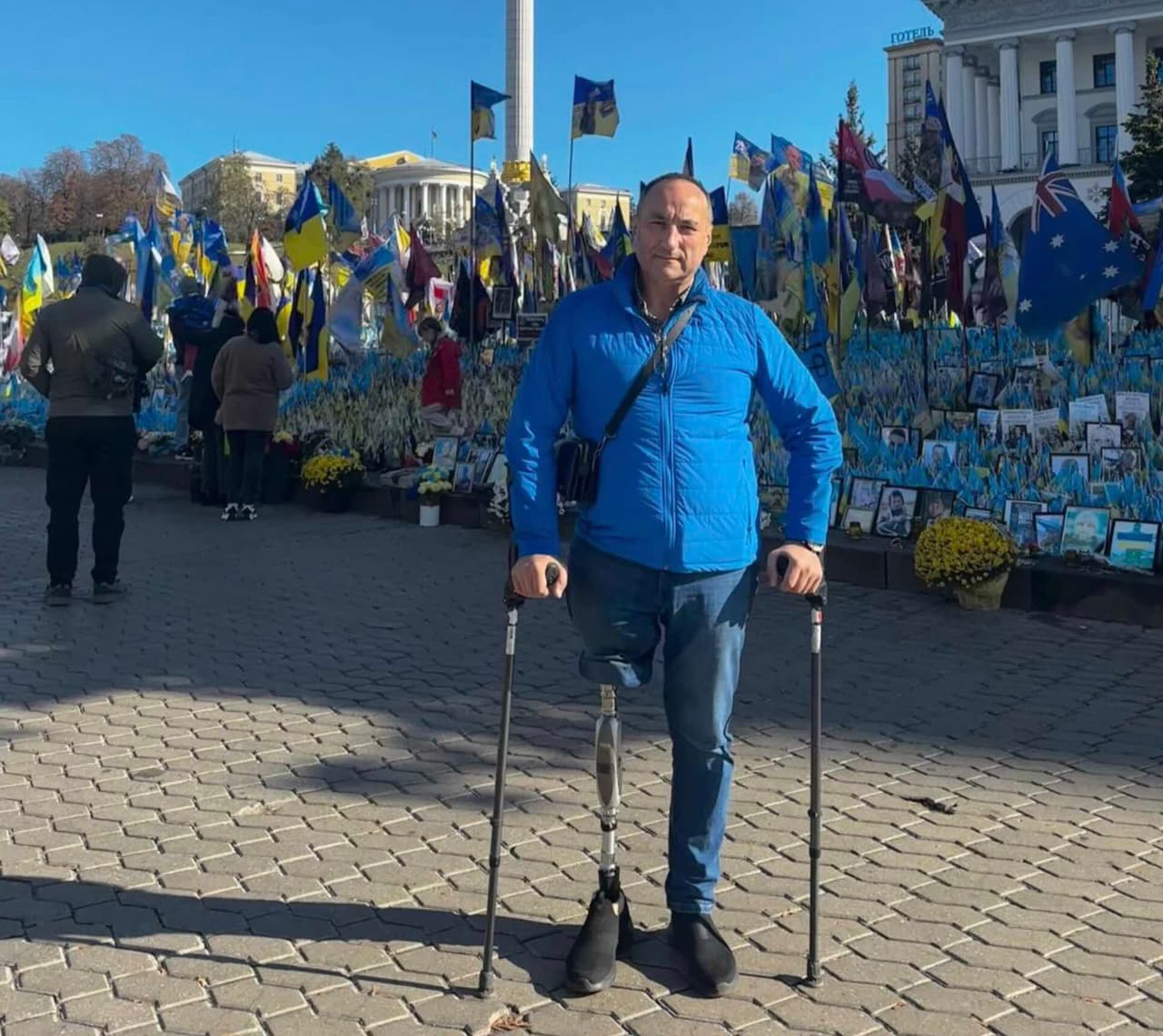 Rusijai teisme teks atsakyti, už tyčia iš pykčio lietuviui nupjautą koją